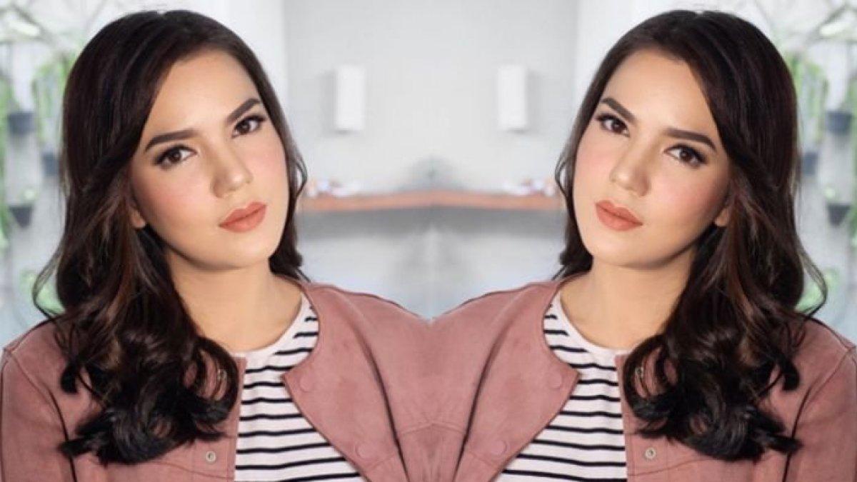Dalam unggahannya terbaru di instagram, Alice Norin membagikan kondisi kesehatannya terkini.