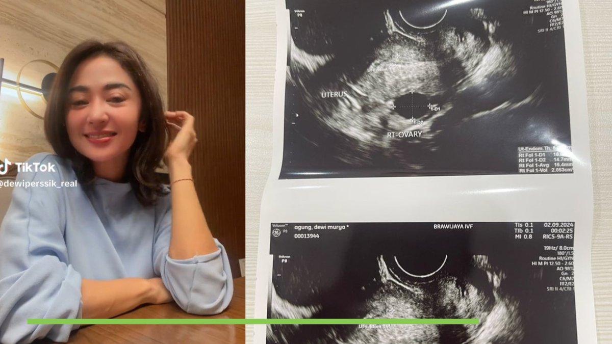 Dewi Perssik Bantah Isu Dirinya Mandul, Buktikan Foto USG Tanda Rahimnya Subur: Tudingan Tak Benar!