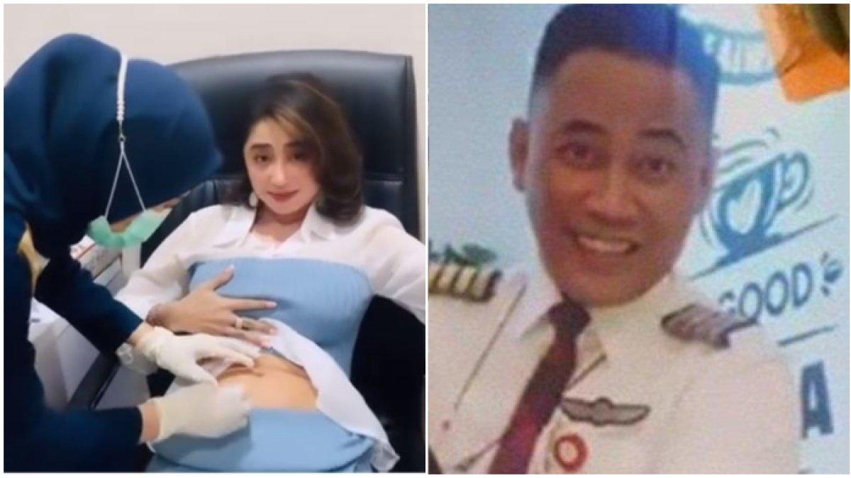 Dewi Perssik bekukan sel telur demi punya anak dari Rully