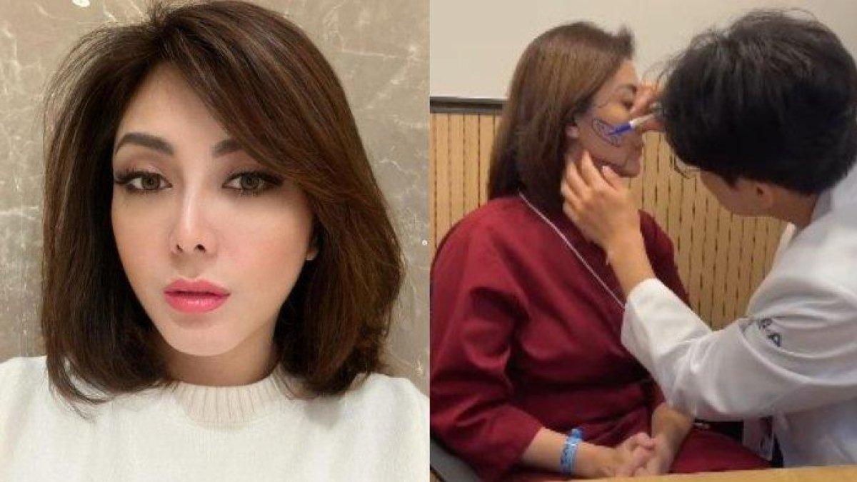 Dhena Devanka akui sempat ada rasa khawatir sebelum lakukan operasi plastik di Korea. Sebut takut dapat hujatan dari masyarakat.