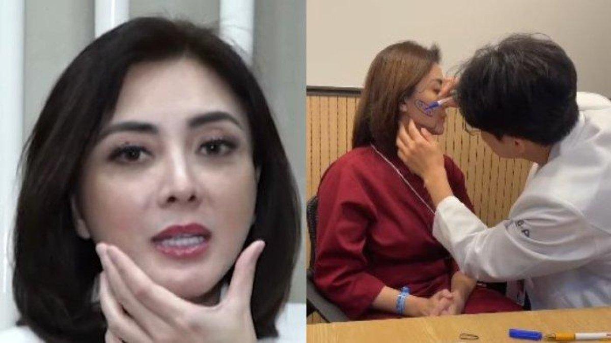 Dhena Devanka lakukan operasi plastik di Korea demi tampil lebih muda. Akui jalani pengurangan lemak pipi dan penambahan lemak di dahi dan bawah mata.