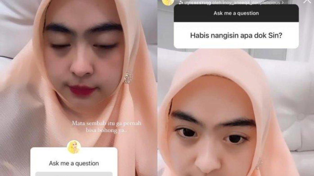 Dokter Shindy Putri Kakak Ria Ricis nangis