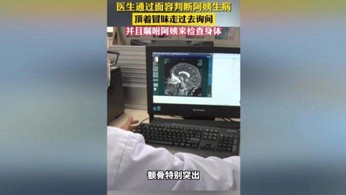 Dokter di China temukan gejala tumor otak pada seorang wanita di restoran a