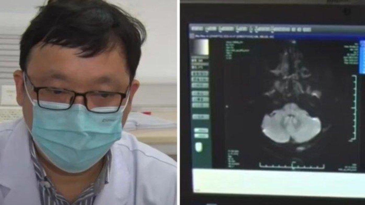 Dokter di China temukan gejala tumor otak pada seorang wanita di restoran