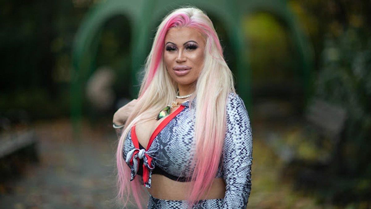 Elaina Starr sudah operasi plastik sebanyak 500 kali.