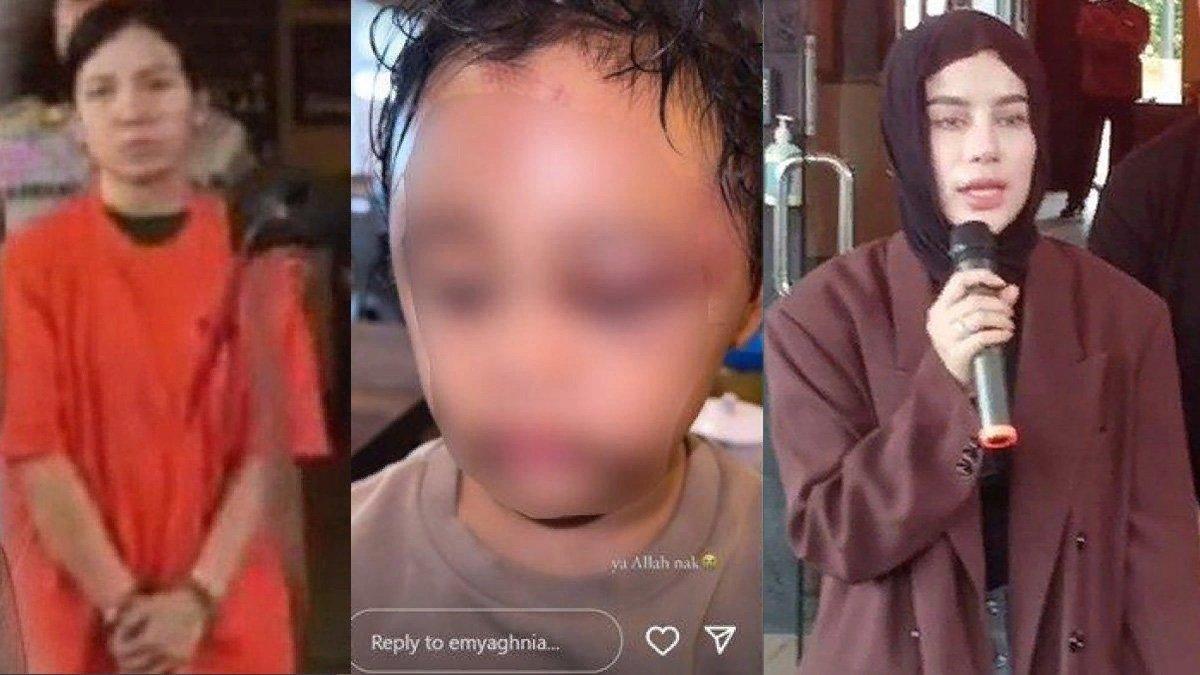 Emy Aghnia Punjabi sebut anaknya, JAP trauma berat usai menjadi korban penganiayaan pengasuhnya.