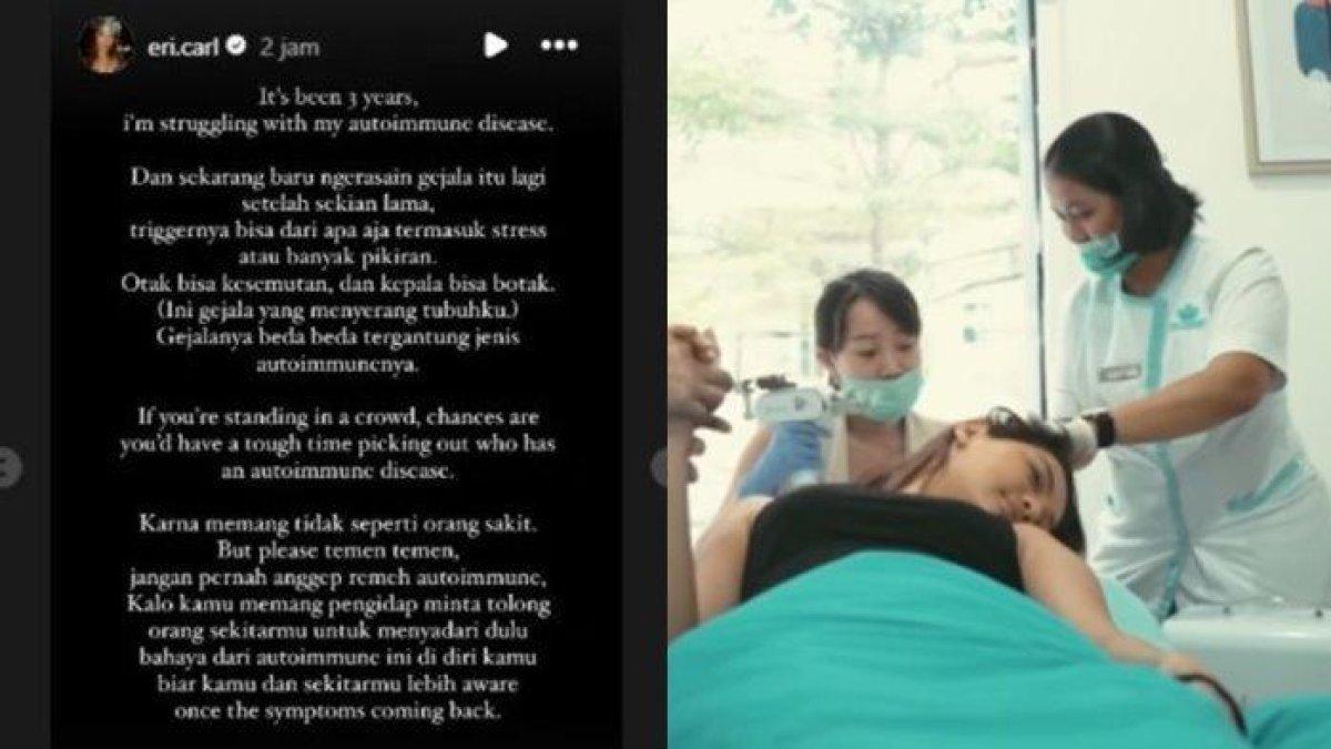 Erika Carlina mengumumkan dirinya mengidap penyakit autoimun sejak tiga tahun