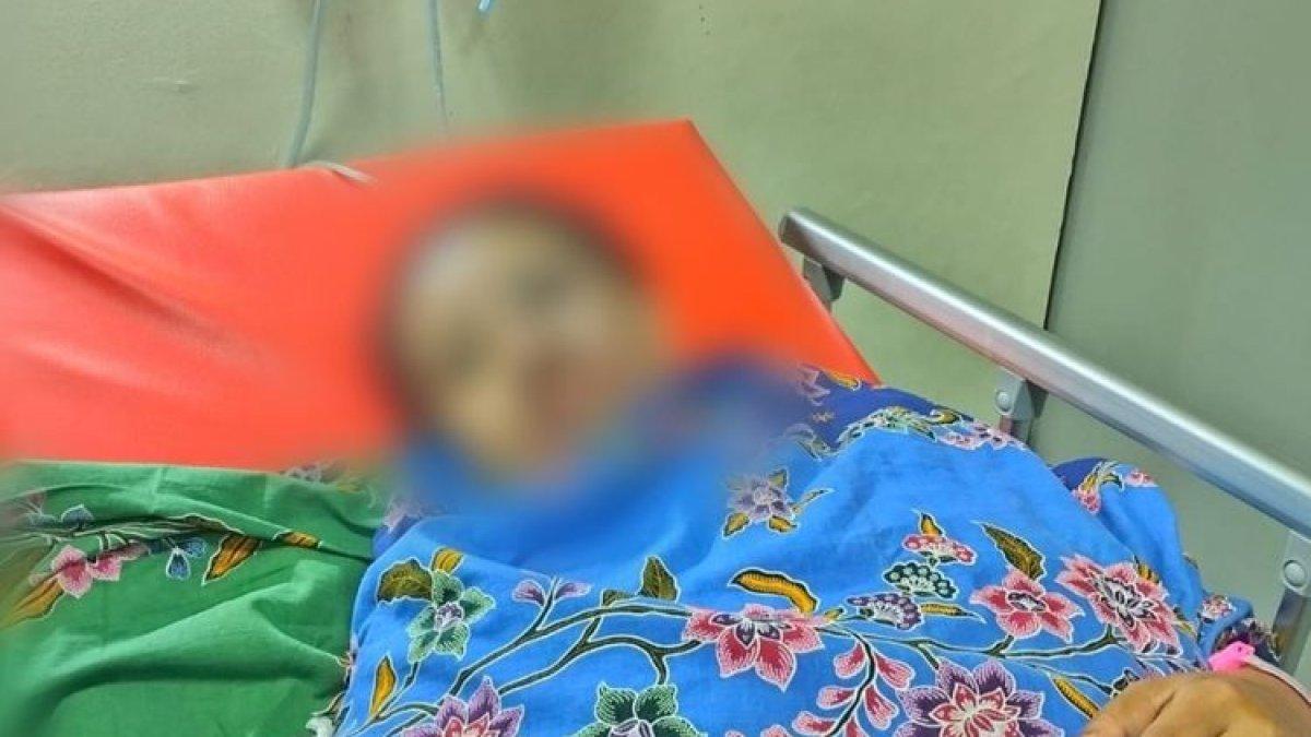 Fika, Korban penyiraman air keras terbaring lemah di atas tempat tidur RSUP Wahidin Sudirohusodo Makassar, Sulsel