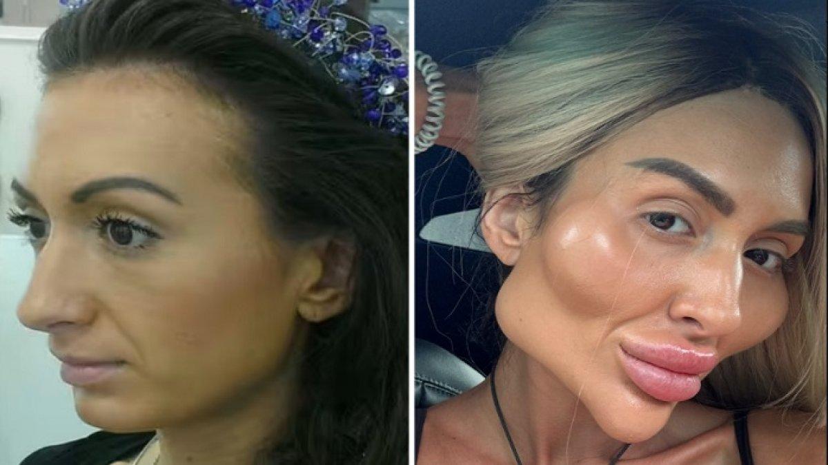 Foto before dan after Anastasiia Pokreshchuk.