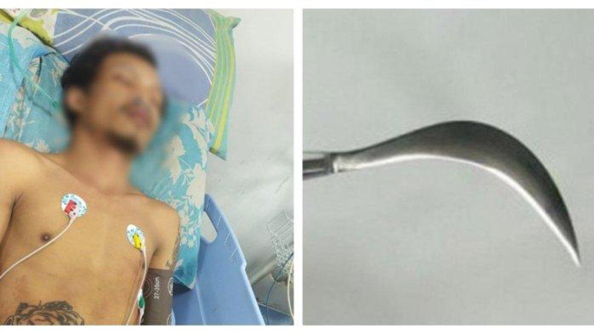 Foto kondisi YR (26), pemuda korban pembacokan oleh pelaku tawuran di Koja, Jakarta Utara. Nasib miris pemuda berinisial YR (26), warga Koja, Jakarta Utara lagi keluar rumah gara-gara suara ribut jadi sasaran pembacokan.