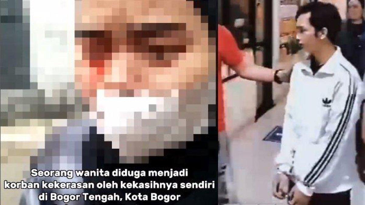 Gadis babak belur dan berdarah dianiaya tunangannya di Bogor.