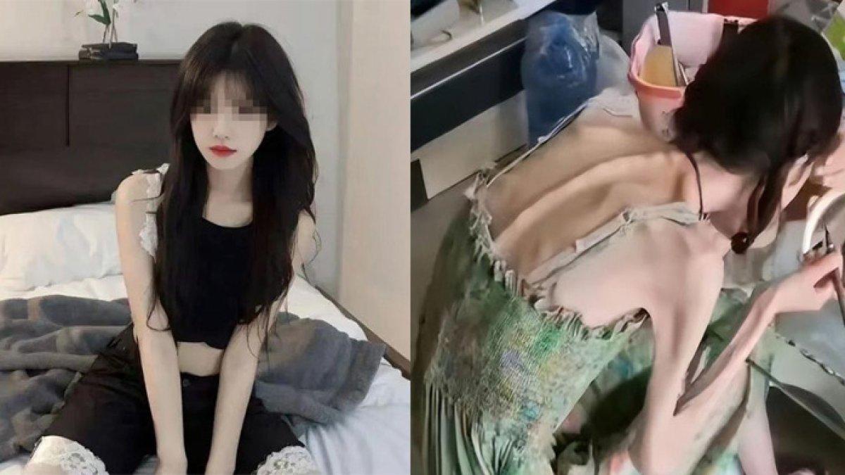 Gadis ikut program diet bareng teman, penampilannya kini memilukan