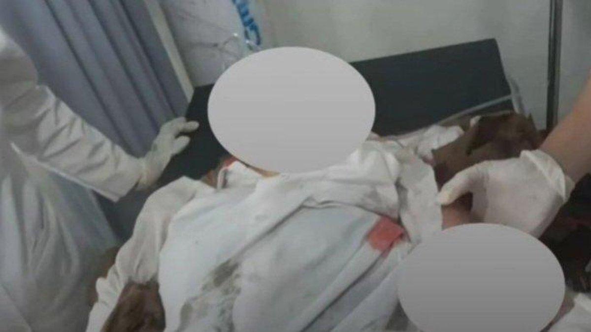 Gadis yang Alami Kecelakaan di Kecamatan Gunung Putri, Kabupaten Bogor, Kamis (29/2/2024).