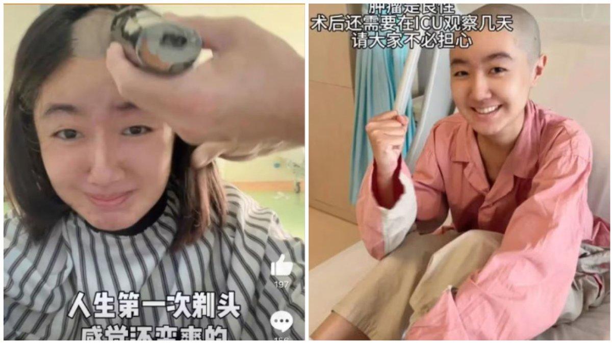 Gao Junyu idap tumor otak