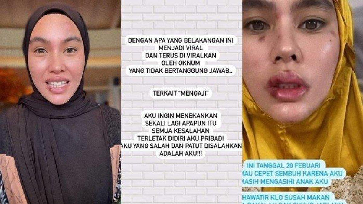 Kartika Putri kini menyampaikan permintaan maaf setelah sempat menantang Capres dan Cawapres untuk unjuk kebolehan dalam mengaji ditengah penyakitnya