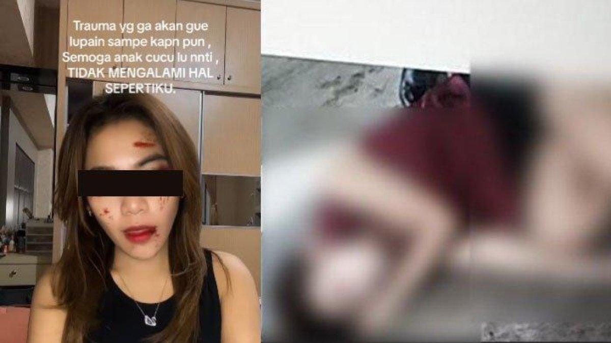 Dini Sera Afrianti tewas dianiaya Ronald, anak DPR RI.