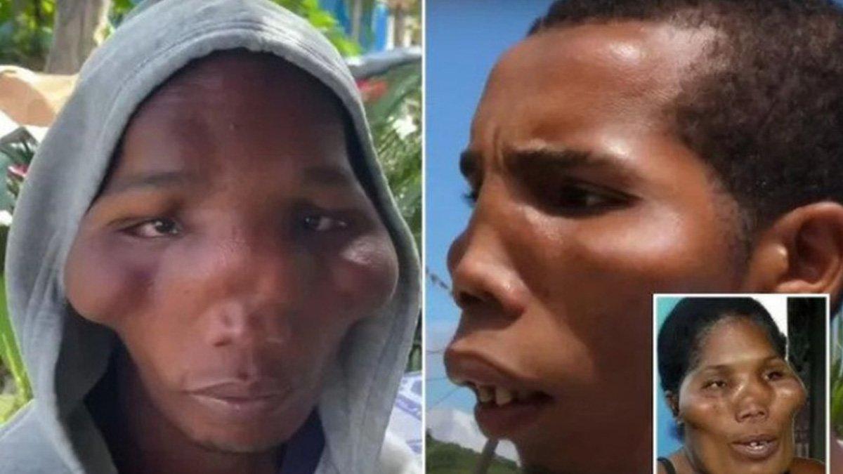 Kelima bersaudara di Republik Dominika kerap jadi korban ejekan dan sering dijuluki 'alien'.