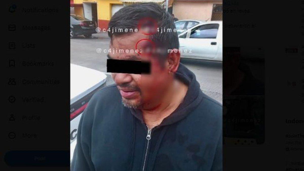 Kepala seorang pria asal Meksiko ditembak dua kali, tetapi terpantul dan hanya menyisakan luka kecil.
