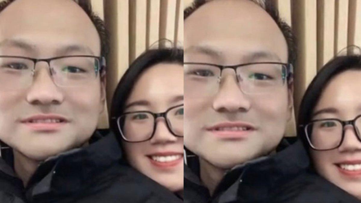 Kesetiaan wanita meski wajah pacar berubah drastis akibat kanker