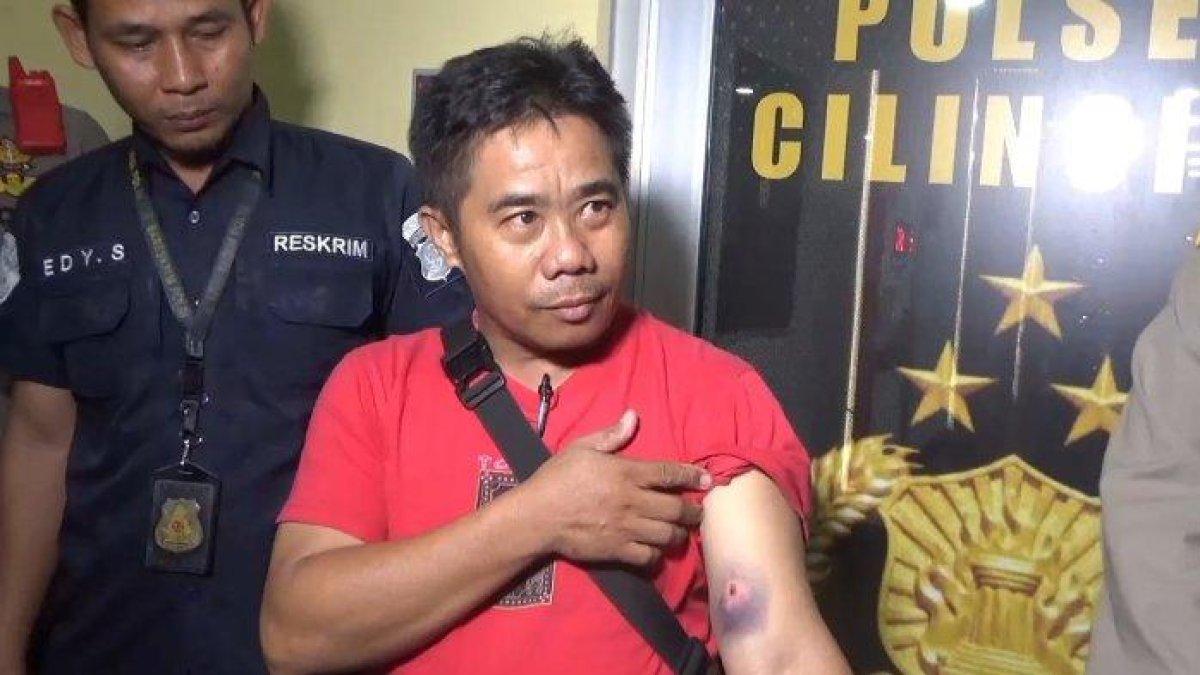Ketua RT 03 RW 010 Semper Barat, Benyamin Pasang Rorre menunjukkan luka tembak yang dialaminya usai berhadapan dengan pelaku pencurian motor bersenjata api.