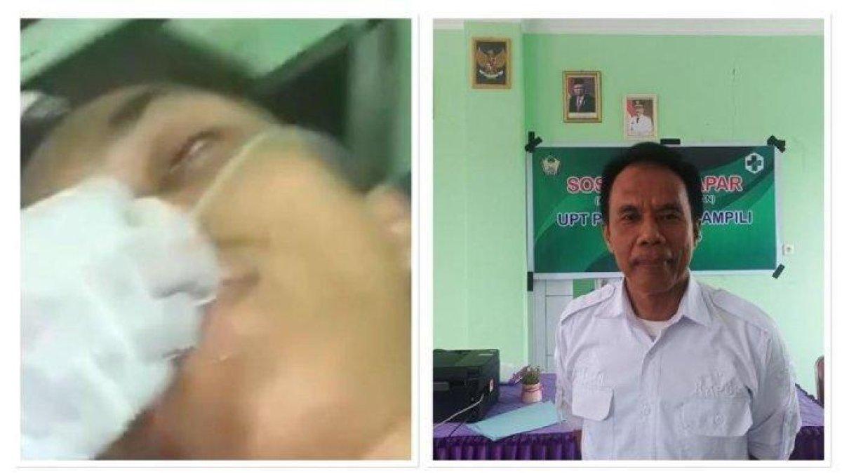 (Kiri) Pria korban kecelakaan. (Kanan) Kepala Puskesmas Kampili, Imran