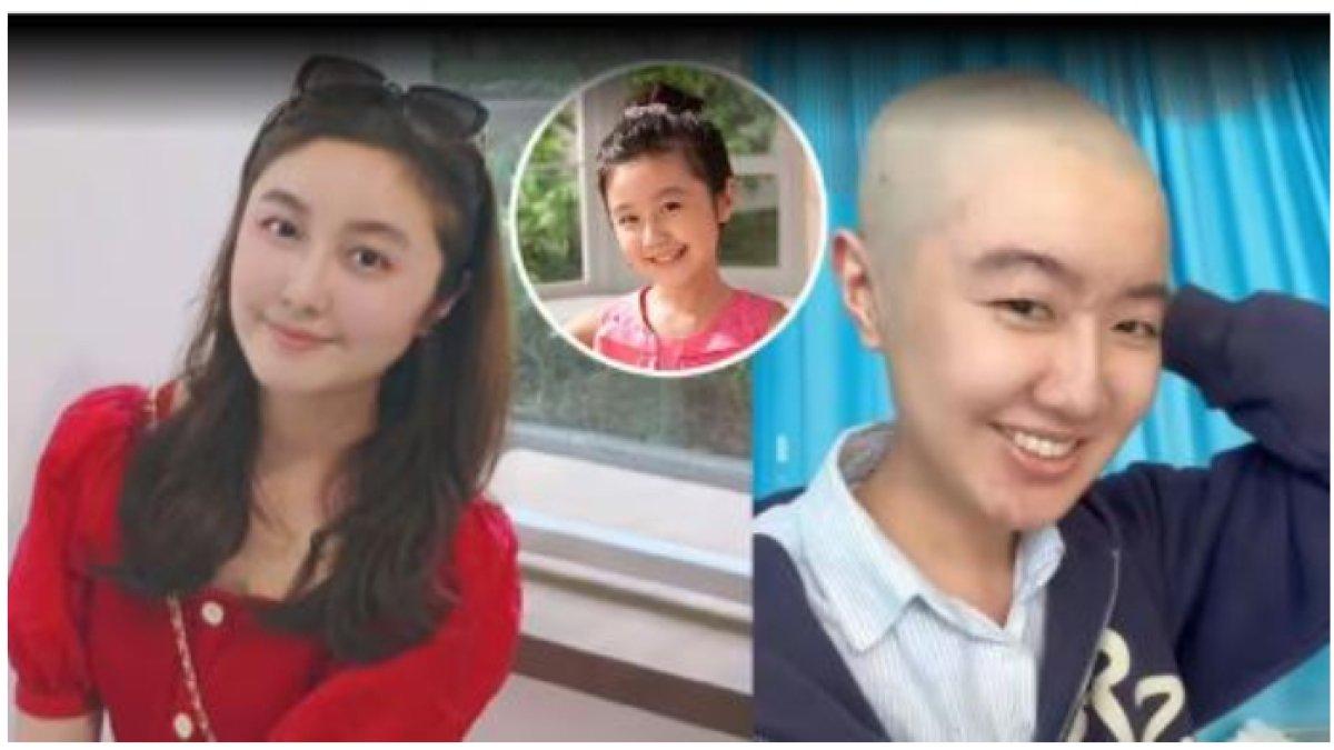 Kisah Gao Junyu, mantan artis cilik yang idap tumor otak