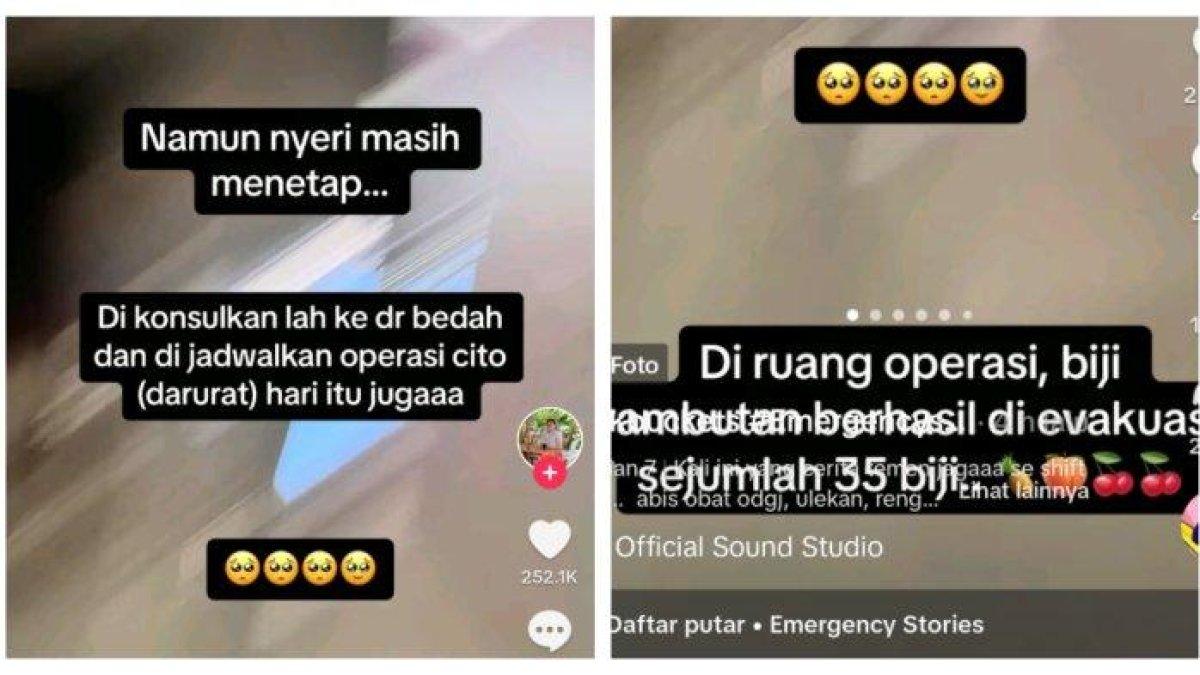 Kisah bocah lelaki mengeluhkan sakit perut usai menelan biji rambutan