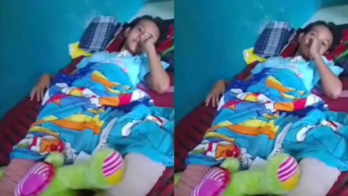 Kondisi Nabila Febrianti setelah kakinya diamputasi