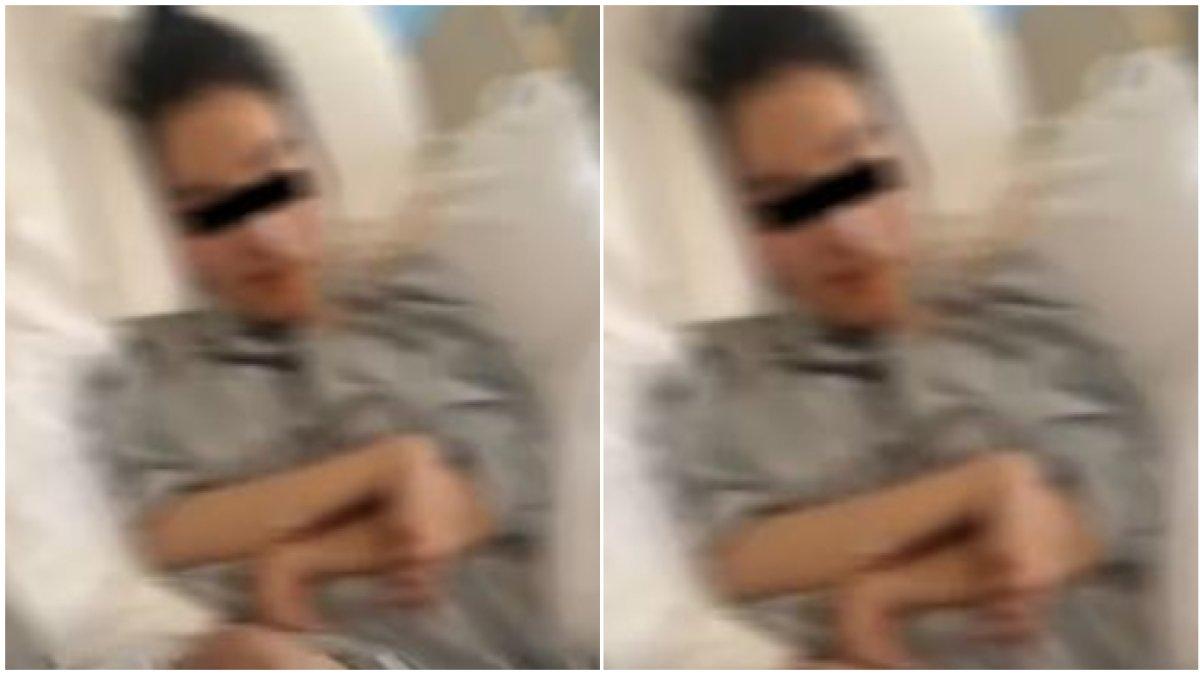 Kondisi pilu wanita setelah oplas, alami lumpuh otak