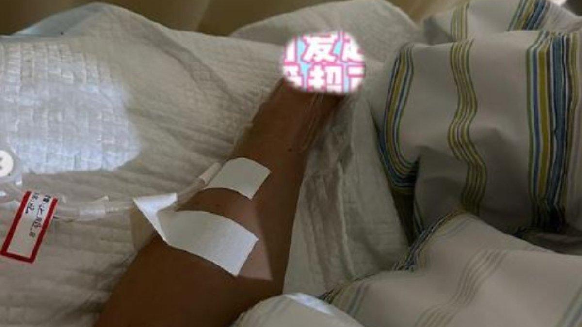 Kondisi tangan Jessica Du yang sudah rusak dan diamputasi