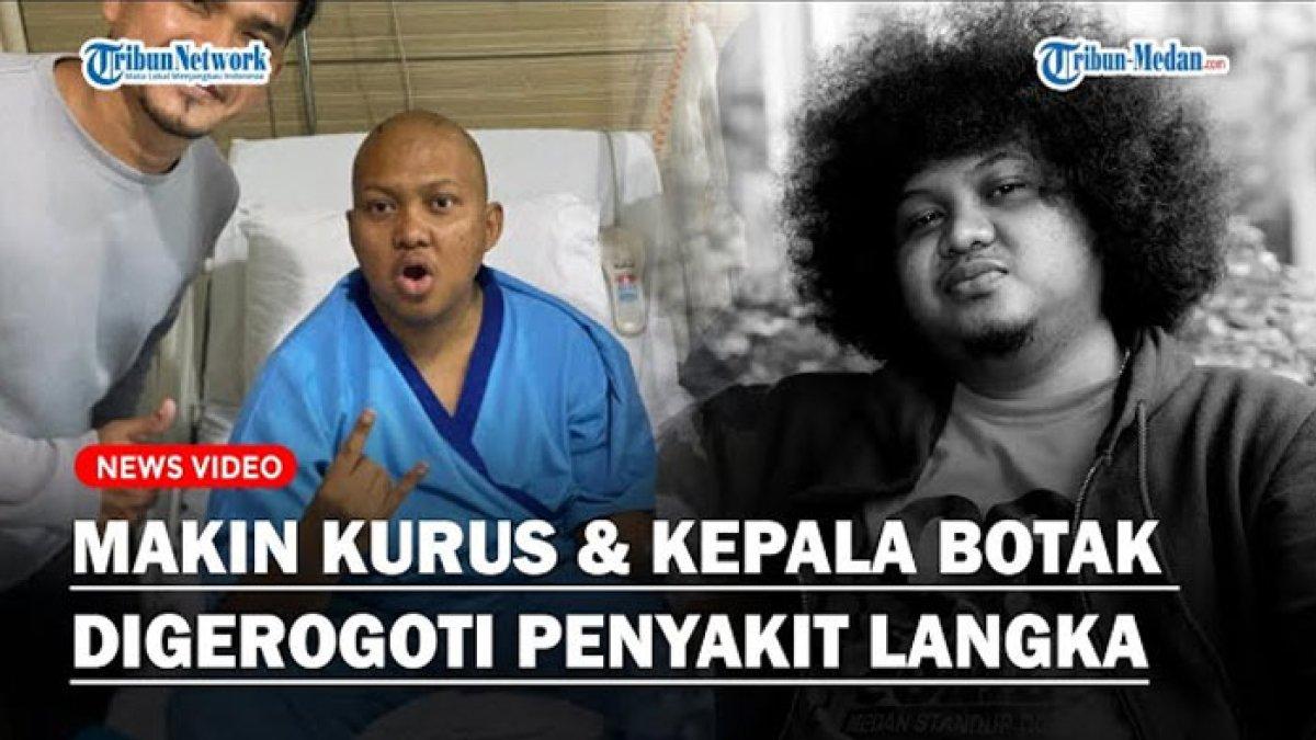 Kondisi terakhir Babe Cabita sebelum meninggal, sangat drop saat dirawat di RS