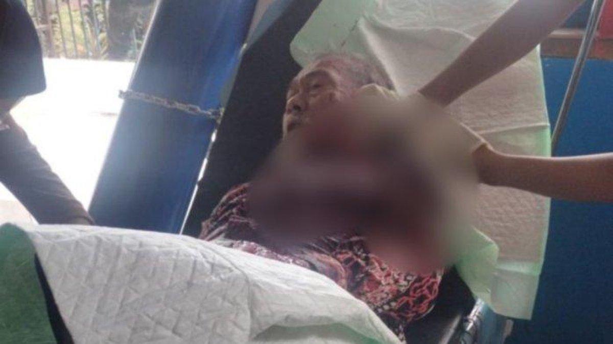 Korban penganiayaan LA (79) saat mendapat perawatan intensif di RSUD Lasinrang usai diparangi terduga pelaku AH (28), Sabtu (30/3/2024).