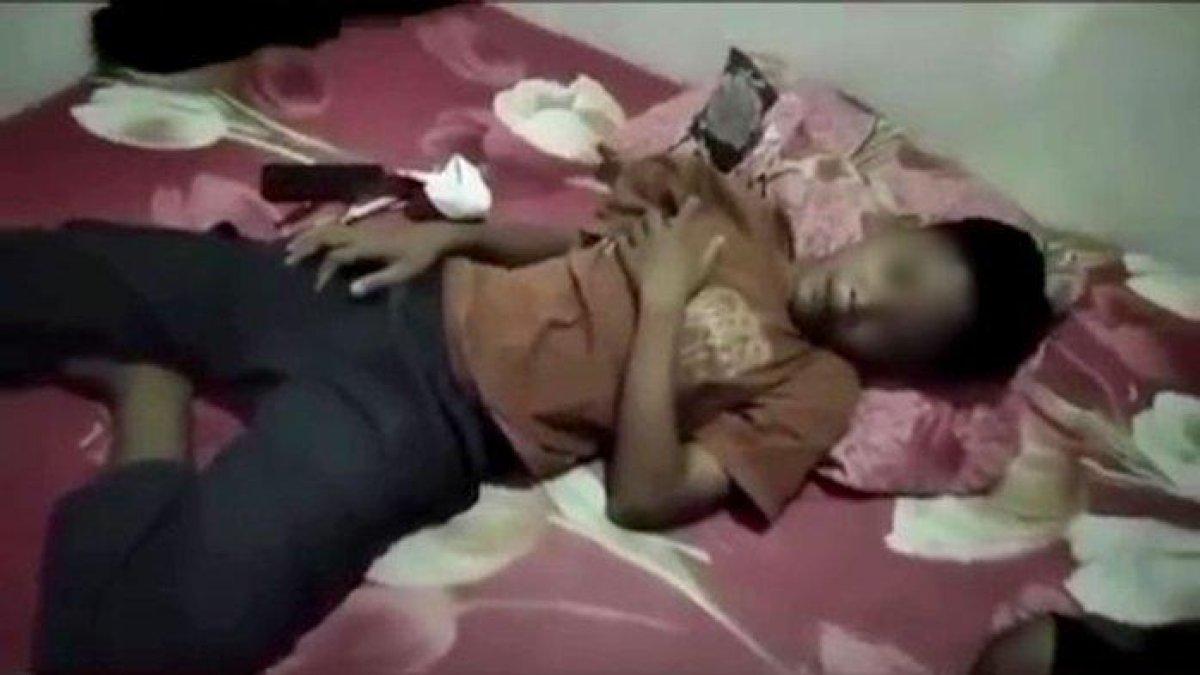 Korban perundungan disertai penganiayaan kakak kelas SMP di Cilacap merasa sesak di bagian dada.