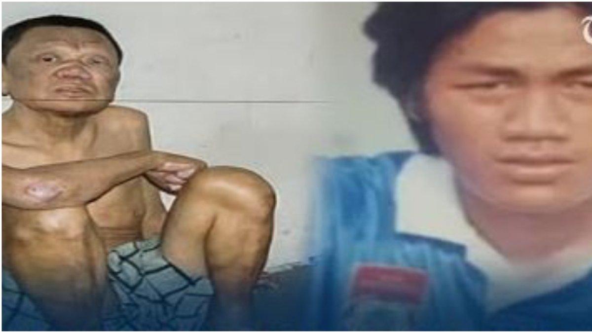 Mantan pemain PSIS Semarang, Budiono Sutikno kondisinya kini memperihatinkan