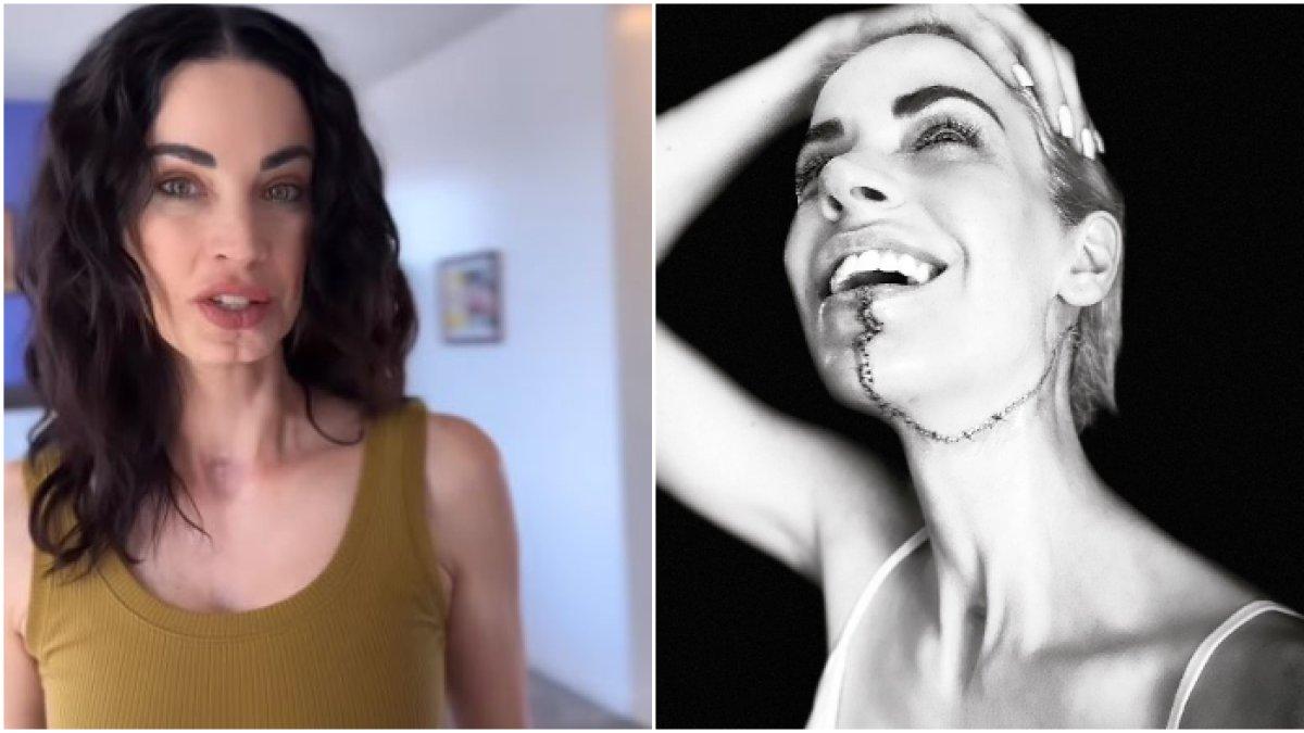 Model Elly idap kanker mulut, kini wajahnya berubah drastis