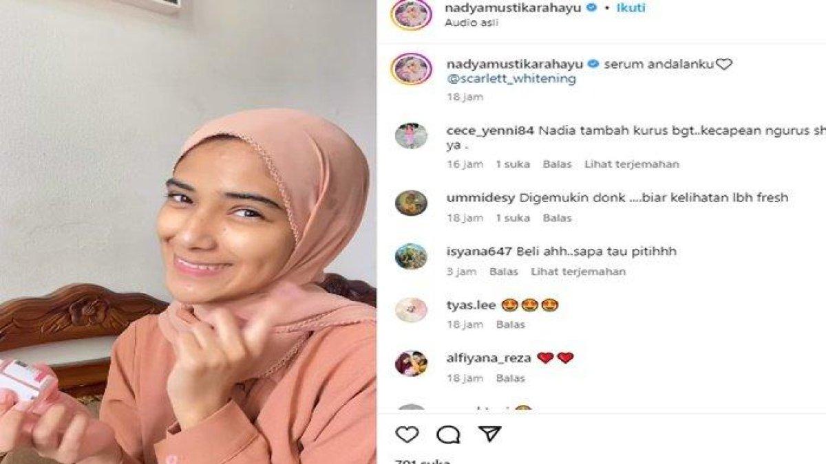 Nadya Mustika disebut terlalu kurus
