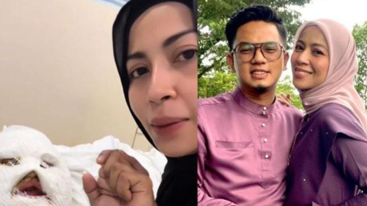 Nasib malang menimpa seorang penyamyi asal Malaysia hingga harus dirawat di rumah sakit gegara kena ledakan tabung gas