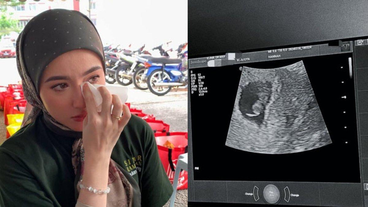 Nasib pilu artis yang hanya 3 bulan merasakan kebahagiaan sebelum mendengar kabar bayi dalam kandungan meninggal dunia