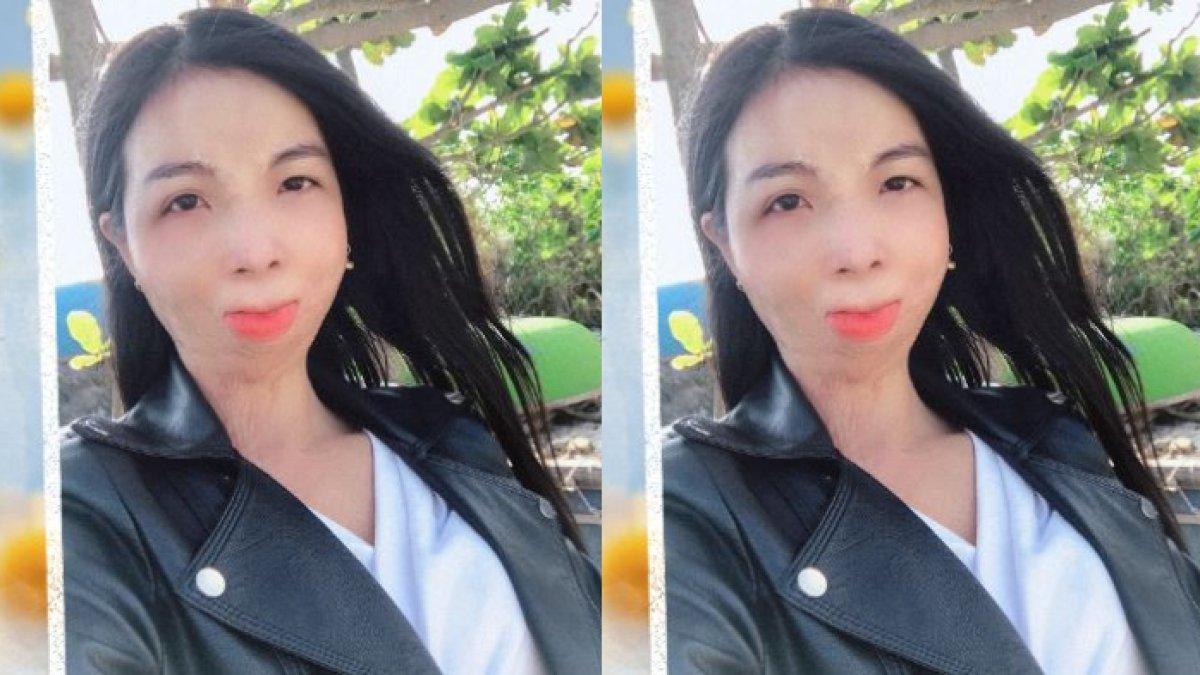 Nguyen Thi Huong cuek dengan cibiran orang tentang wajahnya
