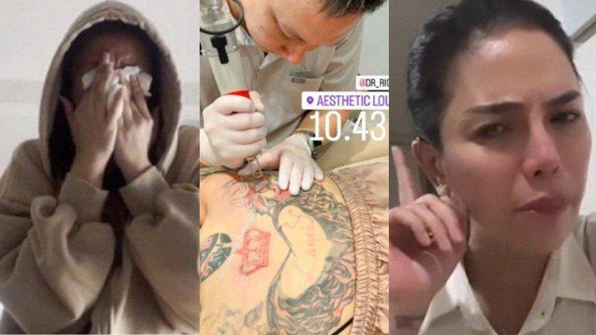 Nikita Mirzani hapus tato nama Lolly dari punggungnya.