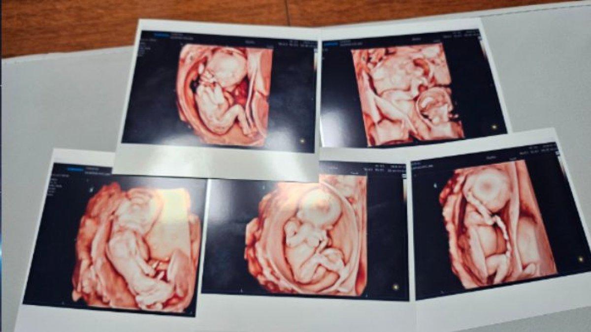 Pasutri Korsel Langsung Kaya Dapat Tabungan Rp2 Miliar setelah lahirkan 5 bayi kembar