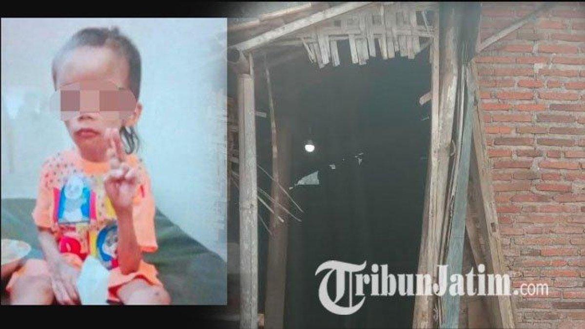 Pilu D (7) bocah di Malang disiksa keluarga, disekap hingga tak diberi makan