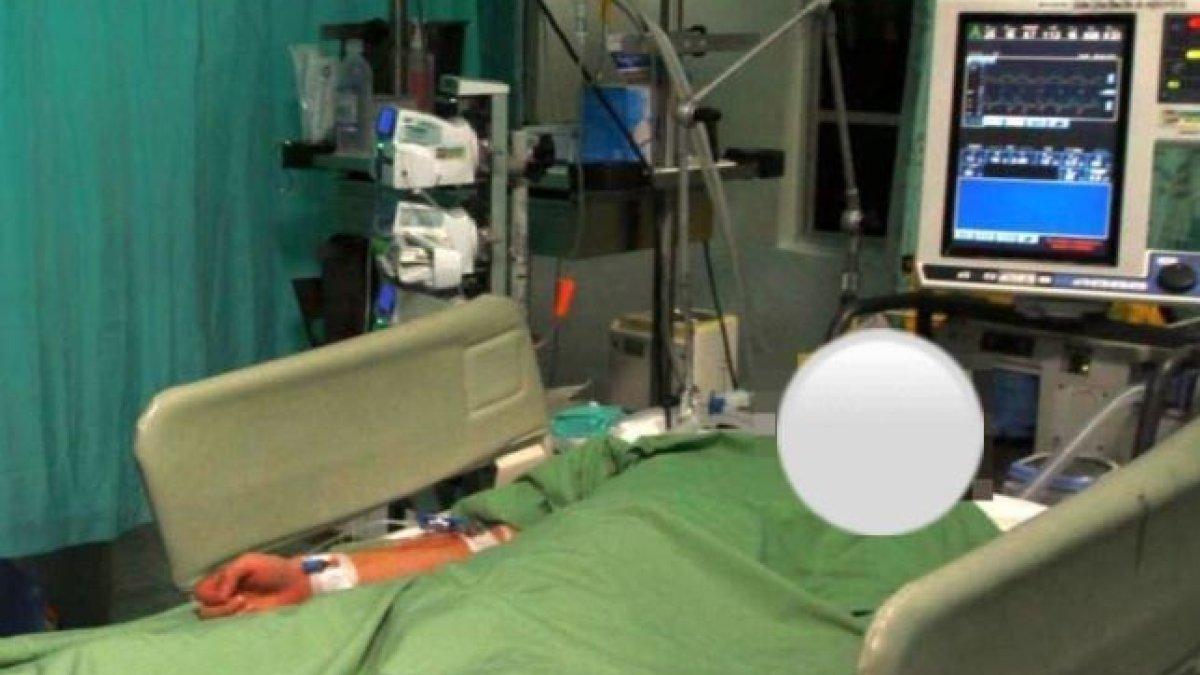 Pilu Wanita di India, Diselingkuhi Suami dan Disiram Air Keras Saat Minta Cerai, Wajah Terbakar