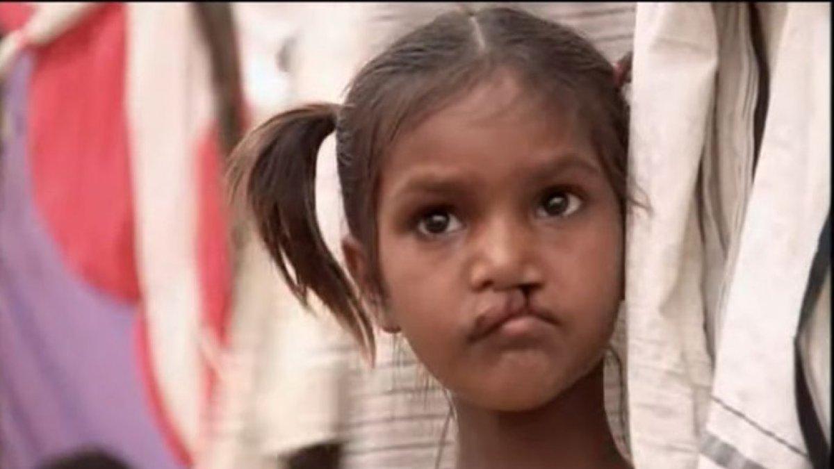 Pinki Sonkar dalam film Smile Pinki, masih berusia 5 tahun