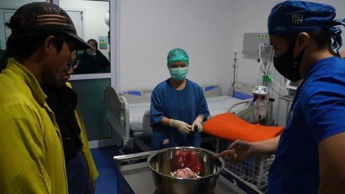 Proses operasi pengangkatan tumor dalam perut bayi di Sumbar
