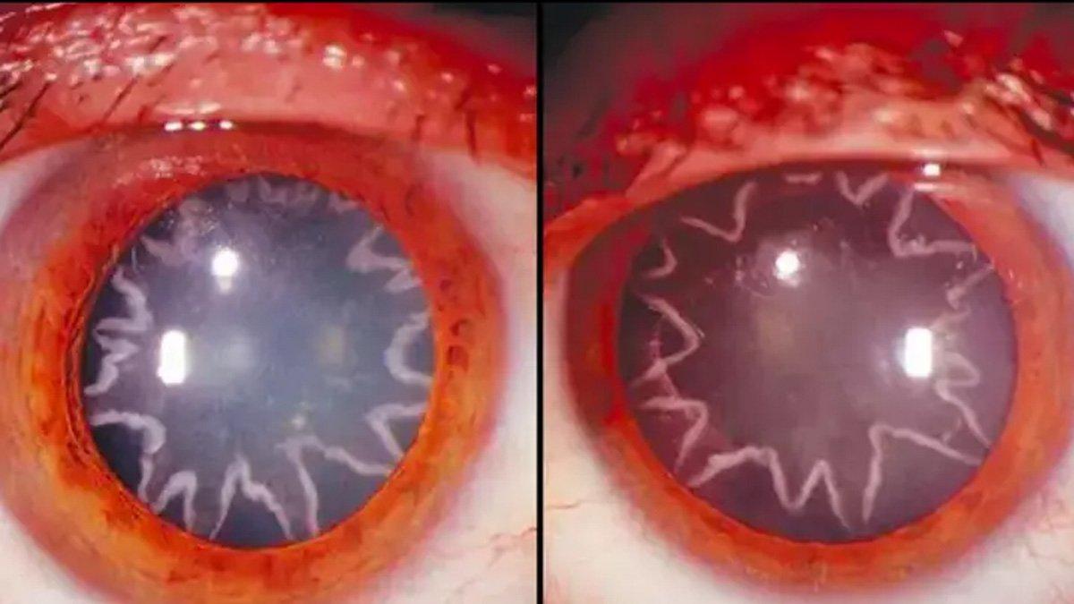 Pupil mata seorang pria bermotif bintang.