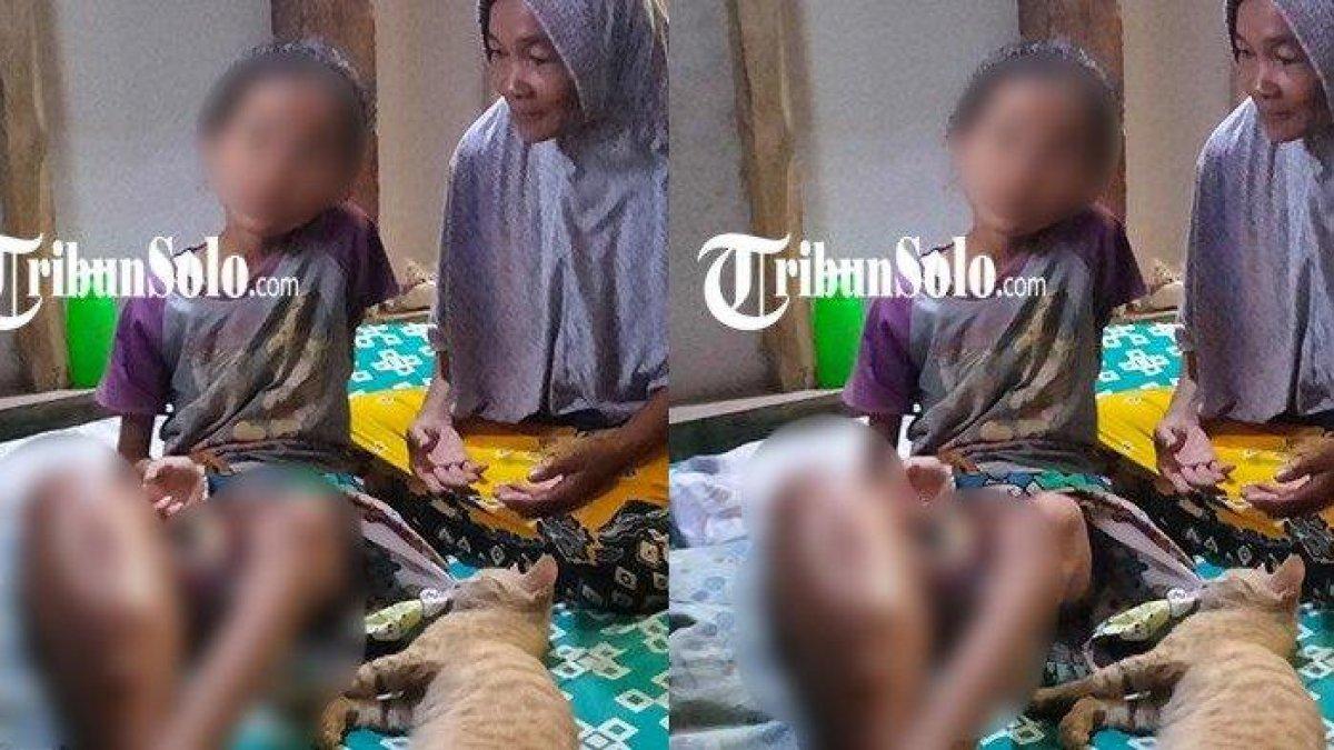 RDC, bocah 9 tahun di Sragen idap tumor di kaki kanan, operasi tak membuahkan hasil a