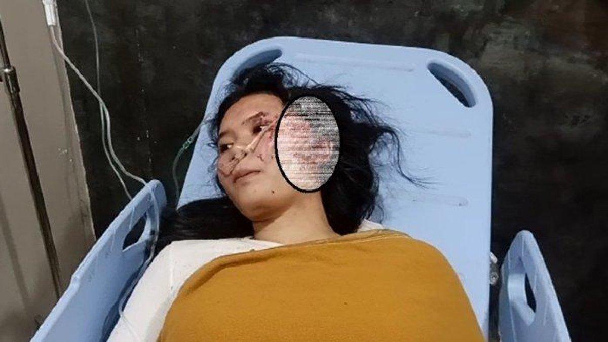 Rahma, korban selamat kecelakaa bus PO Handoyo di Tol Cipali