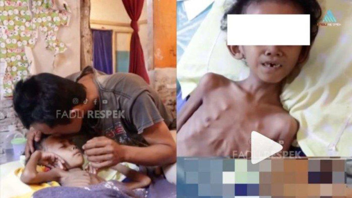 Reyhan yang masih berusia 8 tahun idap tumor ganas.