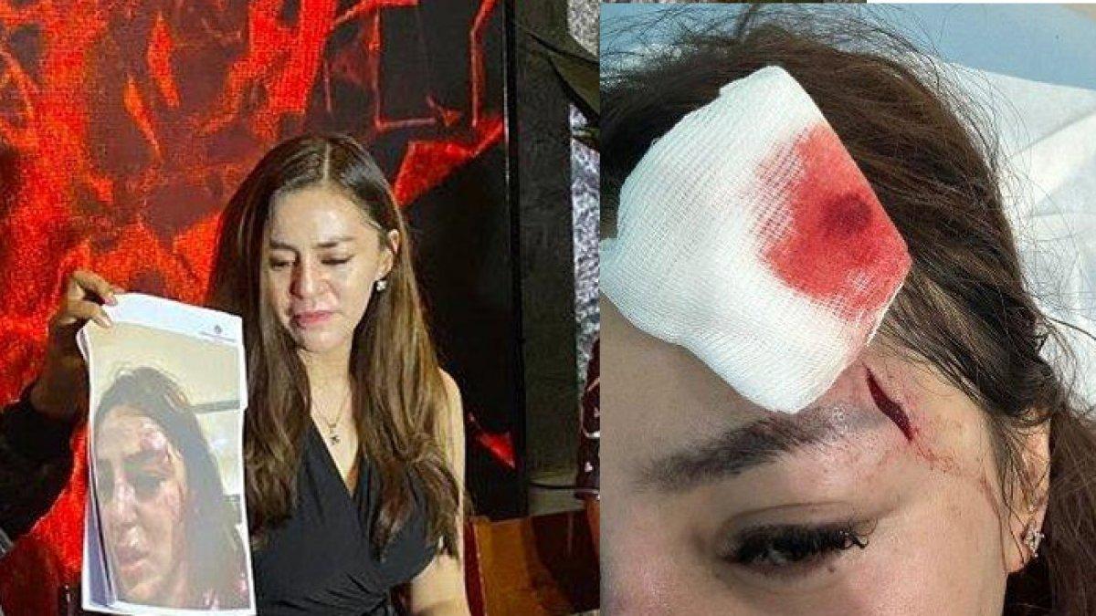 Safa Marwah, artis FTV dianiaya pacarnya yang ASN a